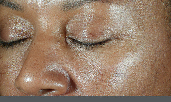 SkinMedica | HA⁵® Hydra Collagen Hydrator with Vegan Collagen