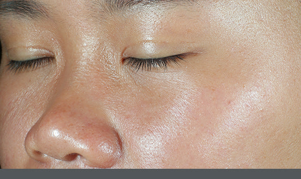 SkinMedica | HA⁵® Hydra Collagen Hydrator with Vegan Collagen