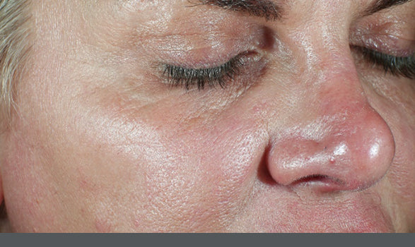 SkinMedica | HA⁵® Hydra Collagen Hydrator with Vegan Collagen