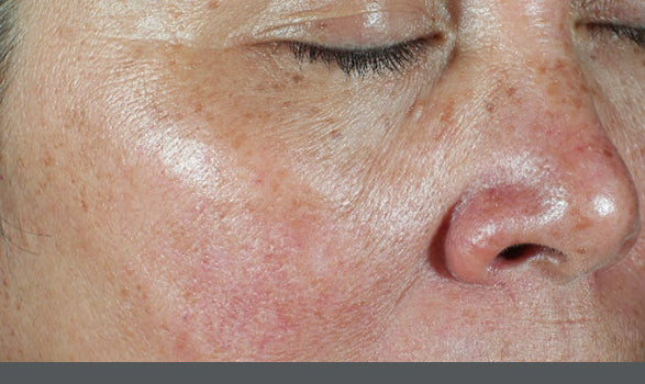 SkinMedica | HA⁵® Hydra Collagen Hydrator with Vegan Collagen